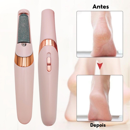 Lixador Pé Elétrico Esfoliador Tira Calos Pedicure Portátil Lixa Podologa Spa dos Pes Elimina Calosidade e Rachadura Usb